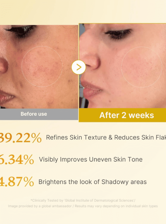 Kojic Acid Turmeric Resurfacing Toner 250ml - 4